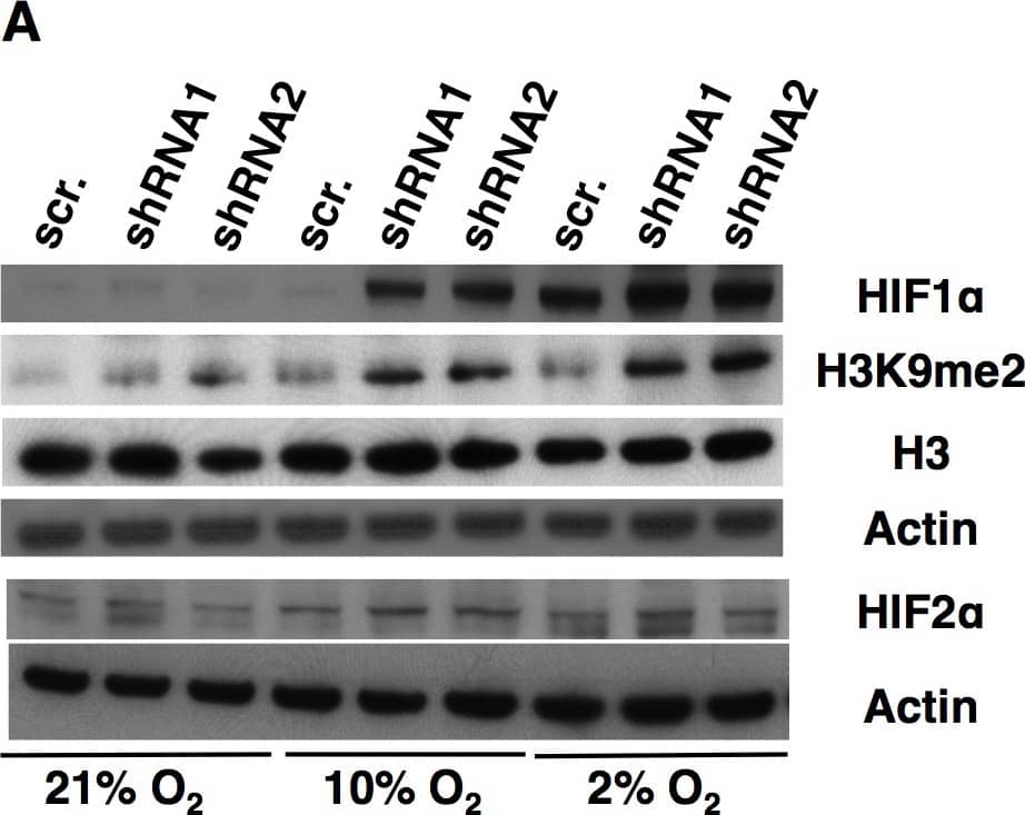 HIF-2 alpha/EPAS1 Antibody (ep190b)