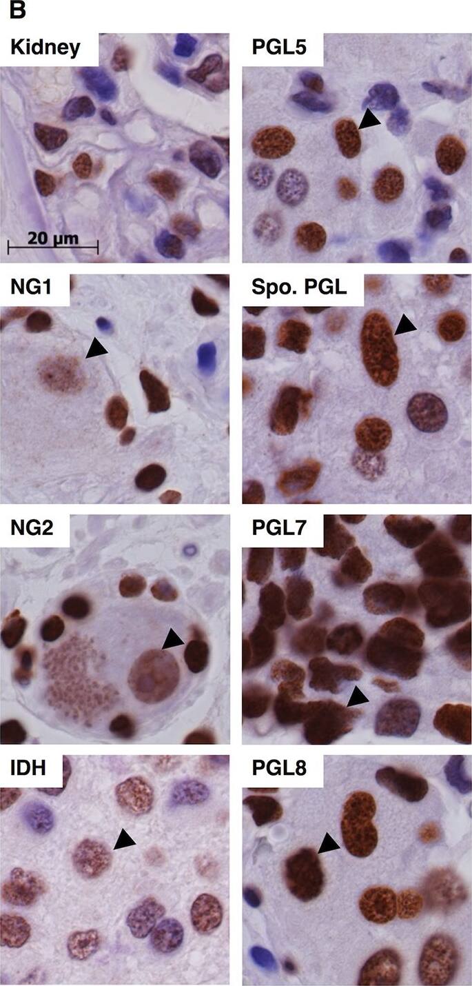 HIF-2 alpha/EPAS1 Antibody (ep190b)