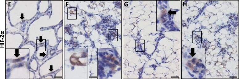 HIF-2 alpha/EPAS1 Antibody (ep190b)