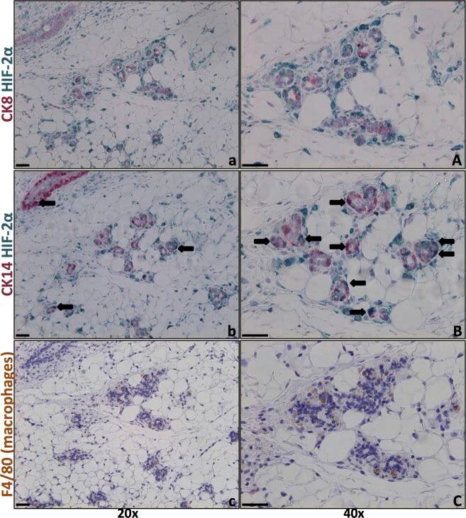 HIF-2 alpha/EPAS1 Antibody (ep190b)