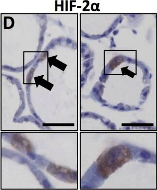 HIF-2 alpha/EPAS1 Antibody (ep190b)