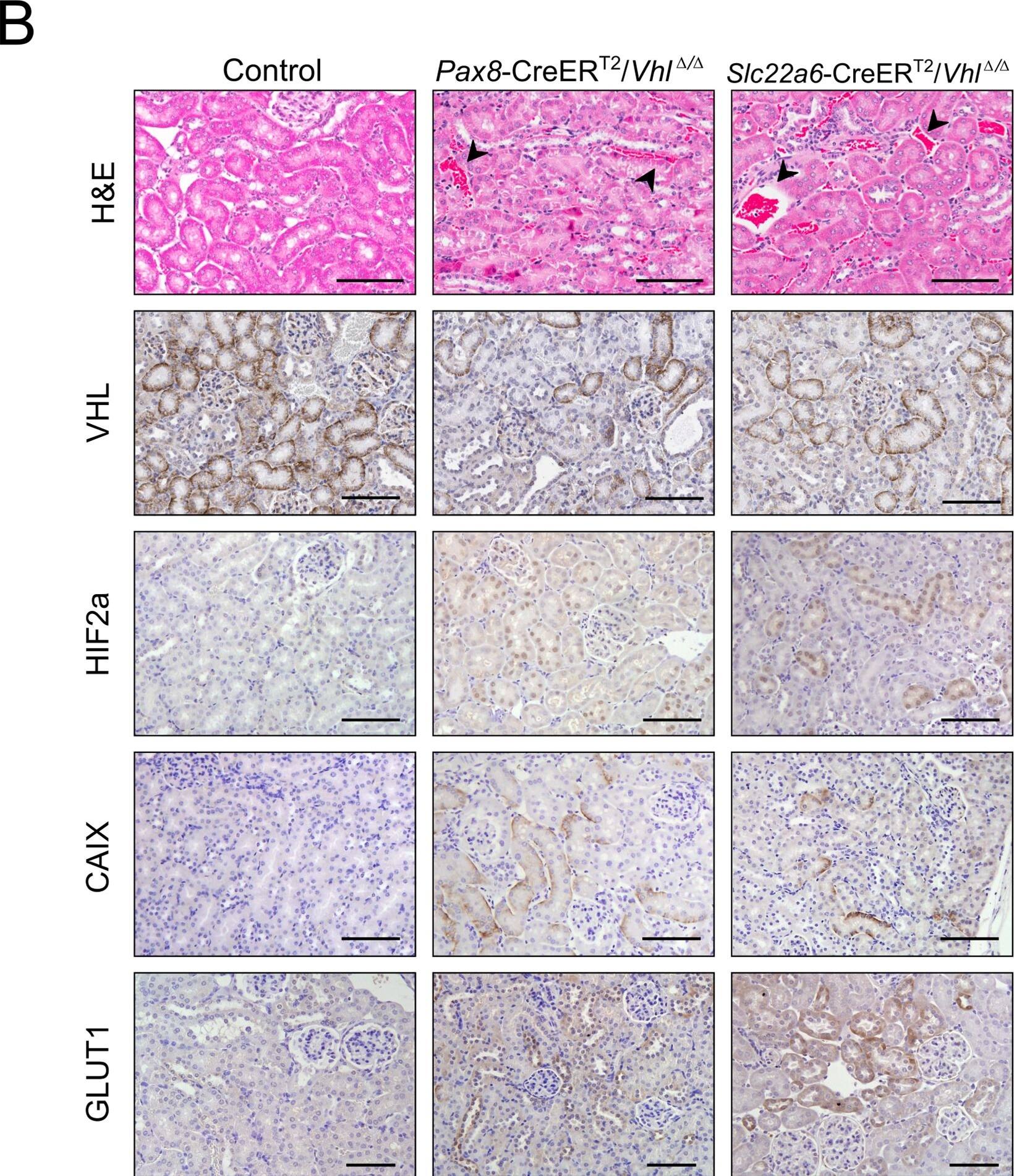 HIF-2 alpha/EPAS1 Antibody (ep190b)
