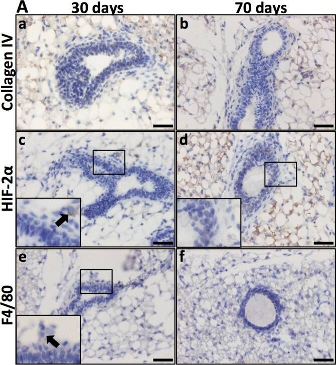 HIF-2 alpha/EPAS1 Antibody (ep190b)