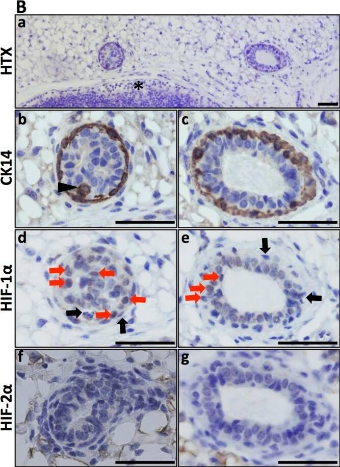 HIF-2 alpha/EPAS1 Antibody (ep190b)