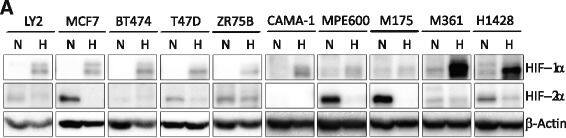 HIF-2 alpha/EPAS1 Antibody (ep190b)