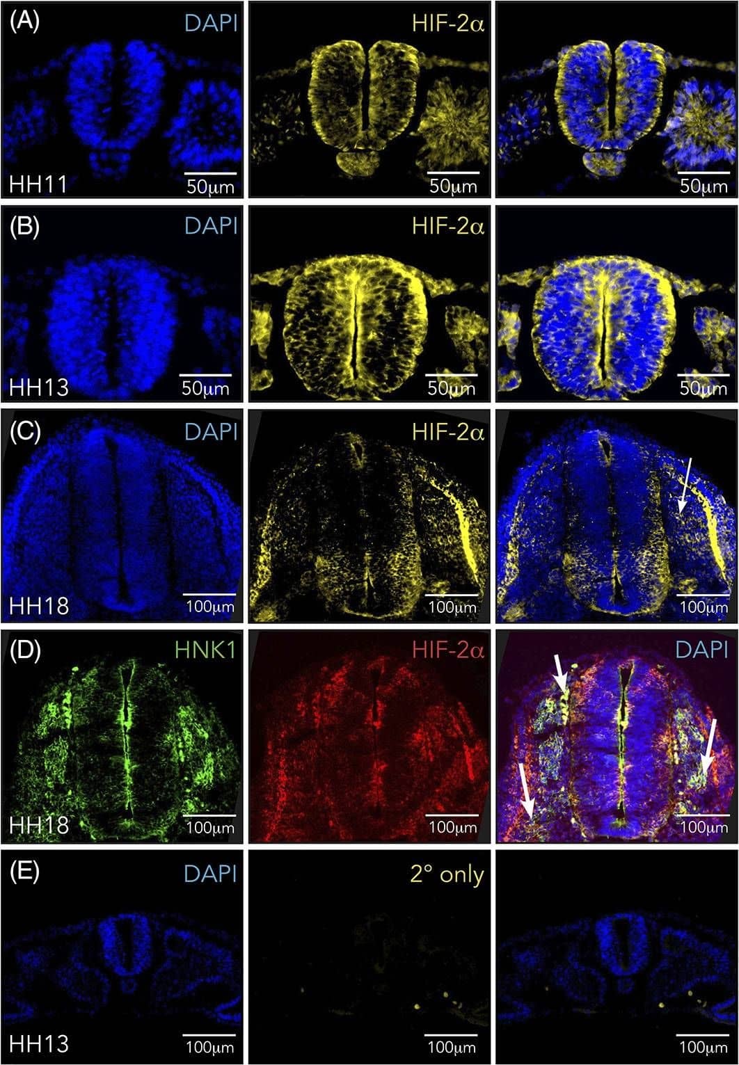 HIF-2 alpha/EPAS1 Antibody (ep190b)