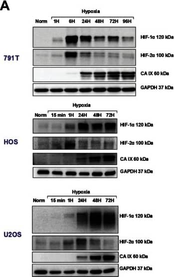 HIF-2 alpha/EPAS1 Antibody (ep190b) [HRP]