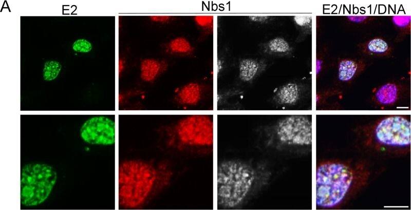 Nbs1 Antibody