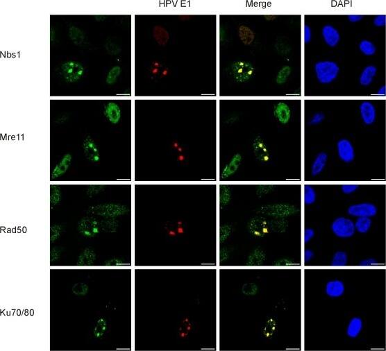 Nbs1 Antibody