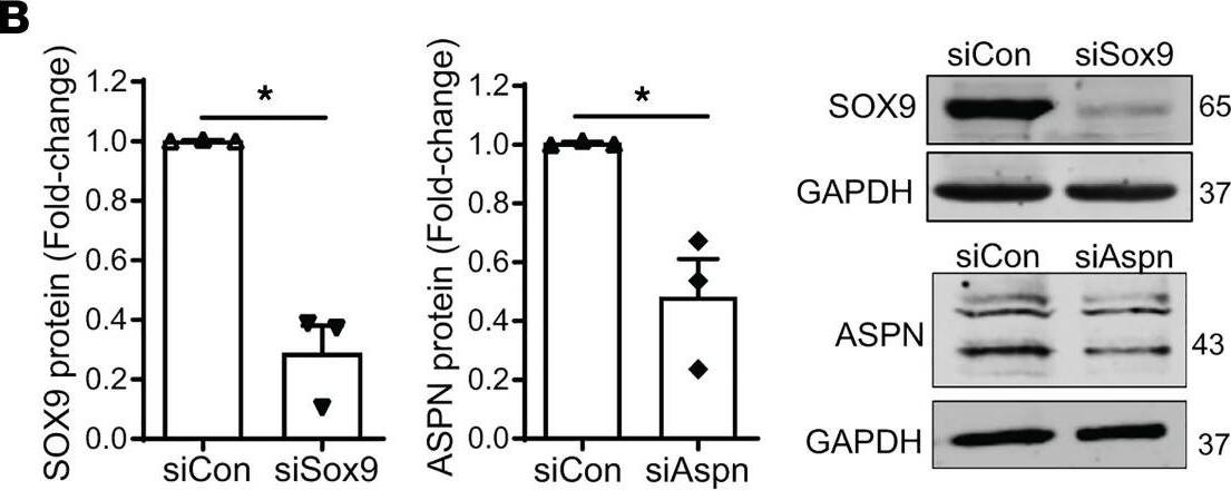 Asporin Antibody