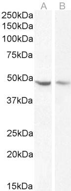 Serpin I1/Neuroserpin Antibody