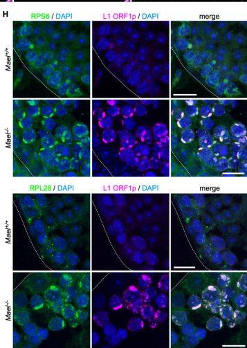 Bio Rp6 Examples Ribosomal Protein S6/RPS6 Antibody (NB100-1595) by Novus, Part of Bio ...