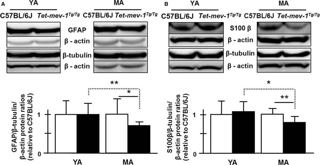 beta-III Tubulin Antibody