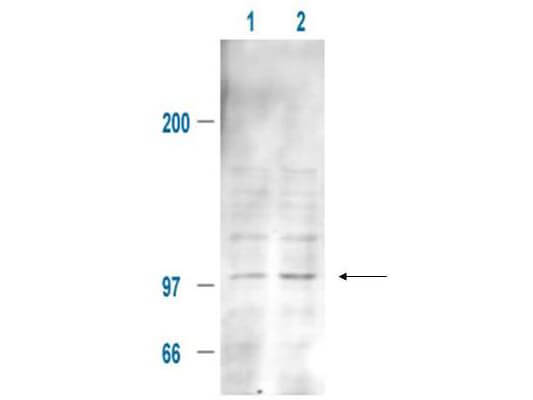 MDM2/HDM2 [p Ser185] Antibody