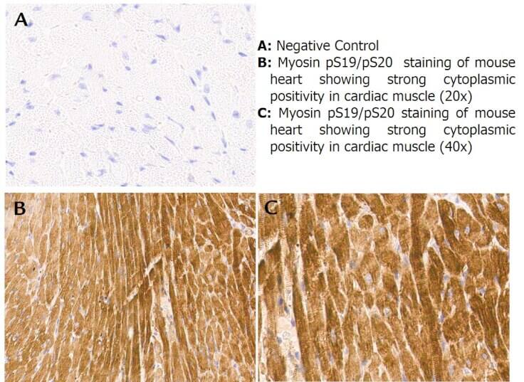 MRCL3 [p Ser19, p Ser20] Antibody