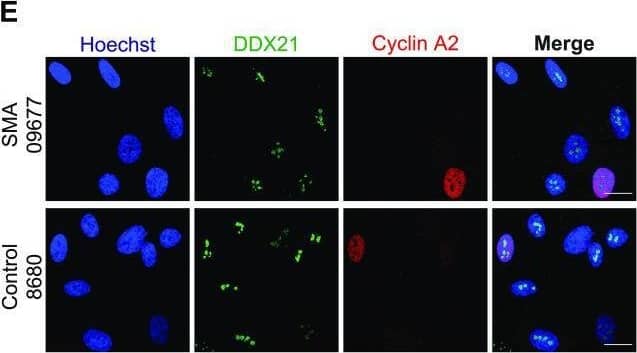 DDX21 Antibody - BSA Free