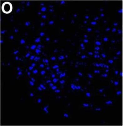 NCOA2 Antibody