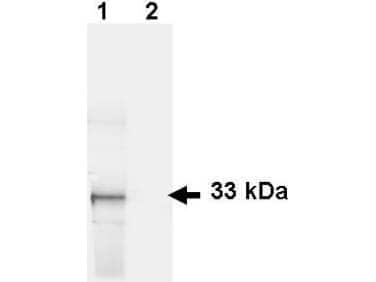 Western Blot Detection of GFP in HeLa Cells