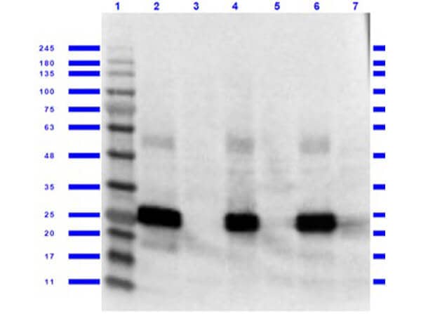 Use of Anti-GFP Antibody in Western Blot