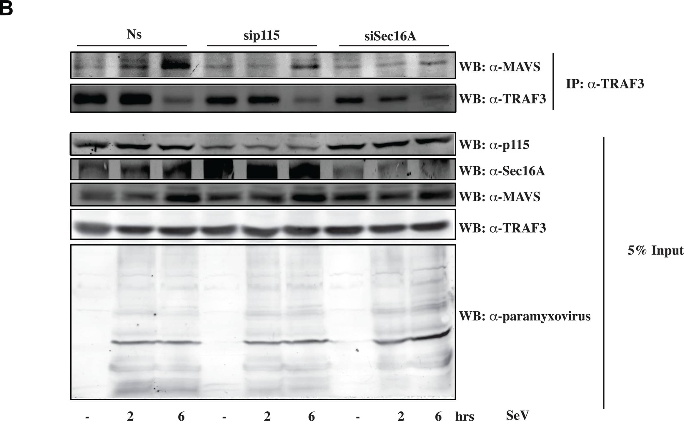 SEC16A Antibody