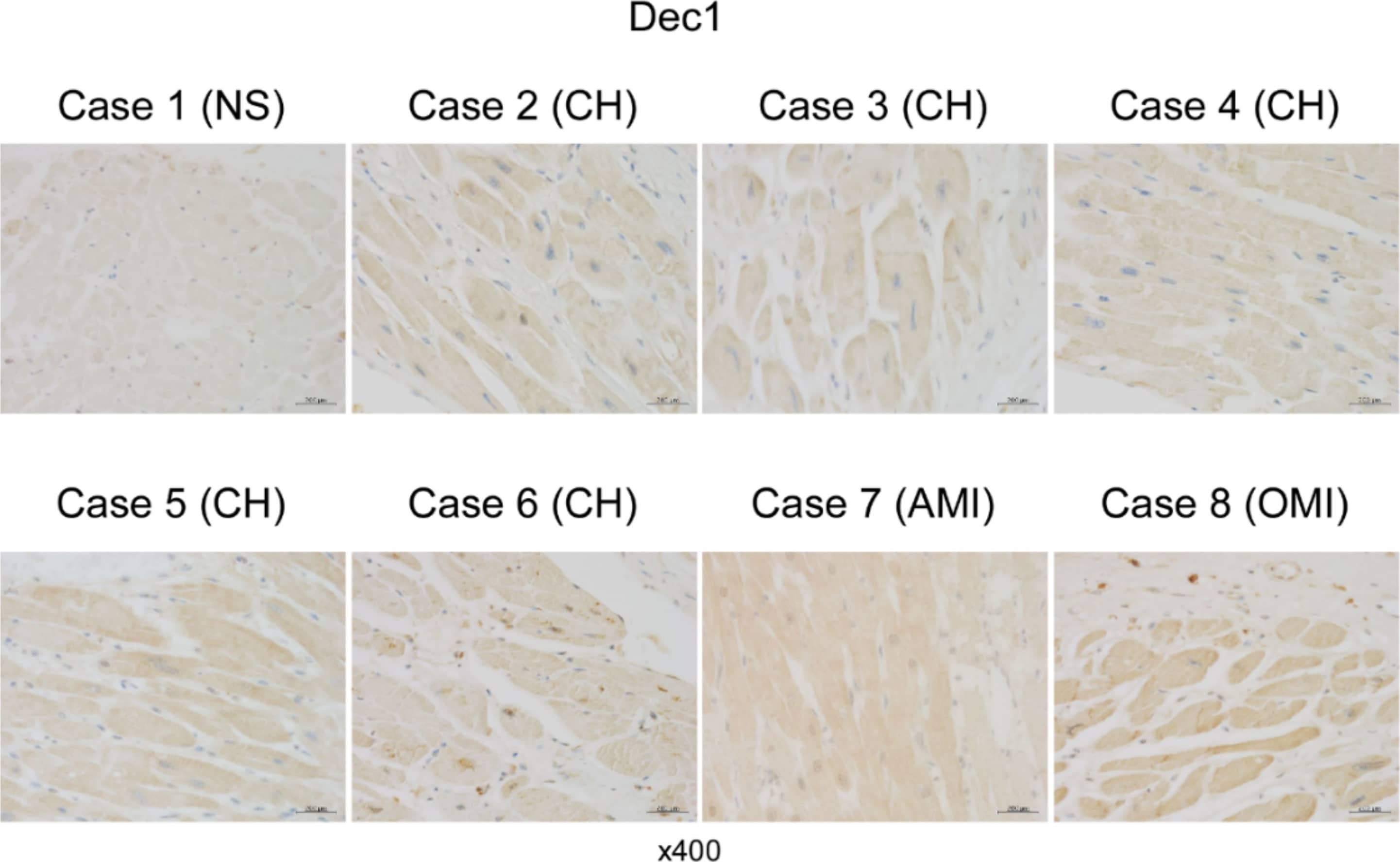 DEC1 Antibody - BSA Free
