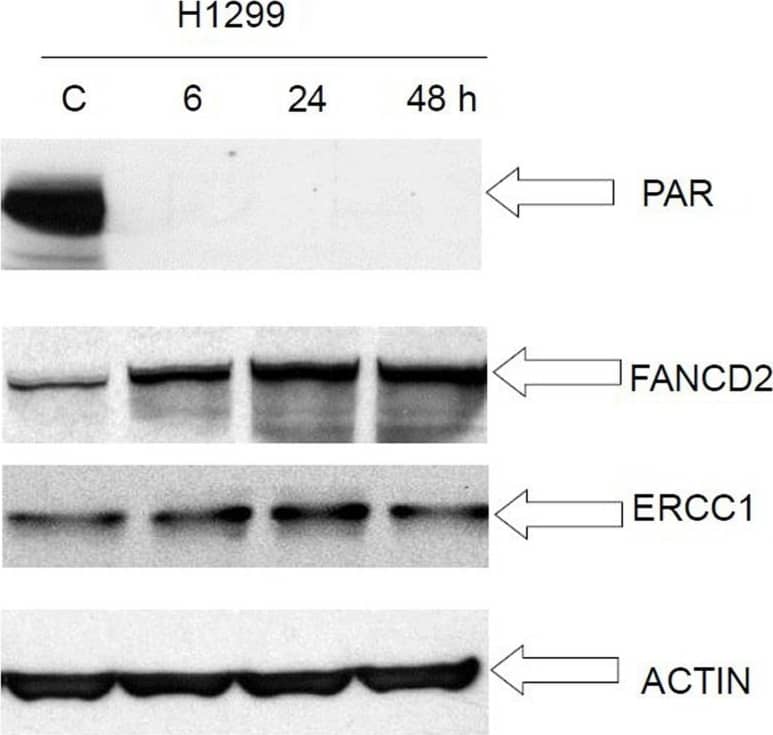 FANCD2 Antibody - BSA Free