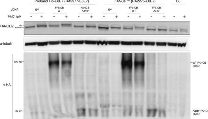 FANCD2 Antibody - BSA Free