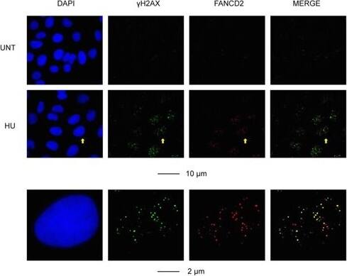 FANCD2 Antibody - BSA Free