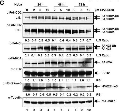 FANCD2 Antibody - BSA Free