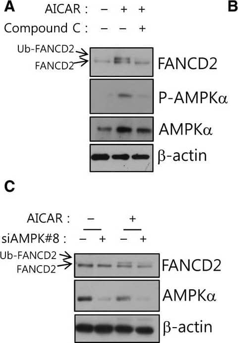 FANCD2 Antibody - BSA Free