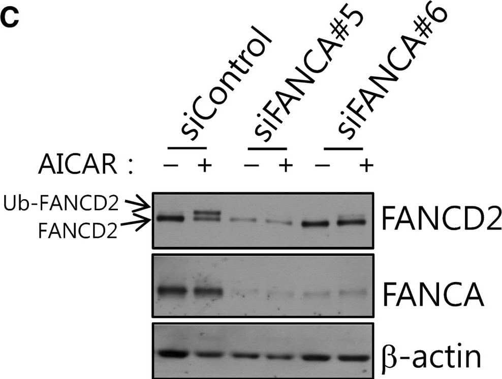 FANCD2 Antibody - BSA Free