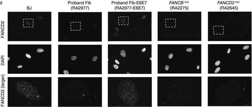 FANCD2 Antibody - BSA Free