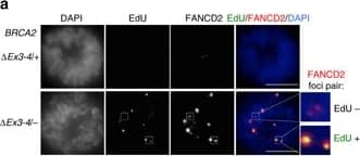 FANCD2 Antibody - BSA Free