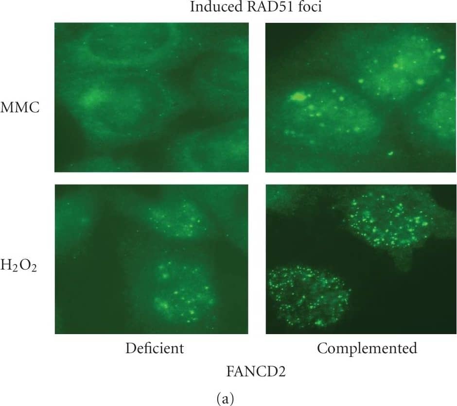 FANCD2 Antibody - BSA Free