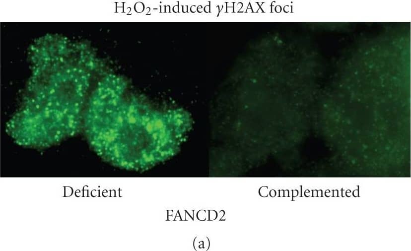 FANCD2 Antibody - BSA Free