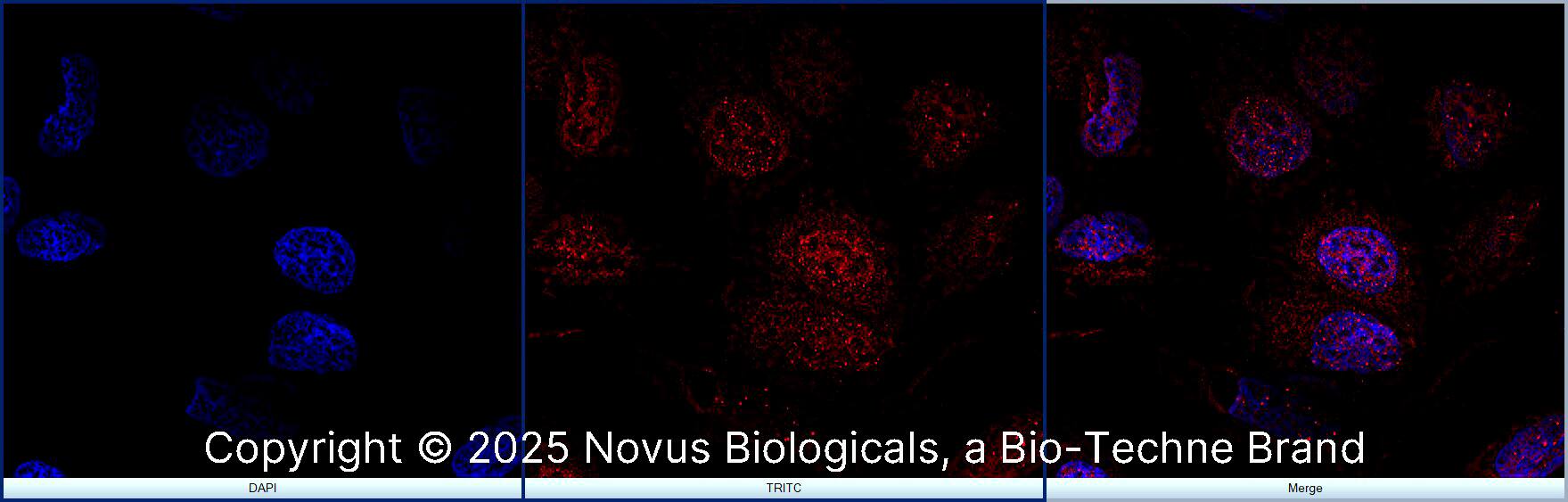 FANCD2 Antibody [Biotin]