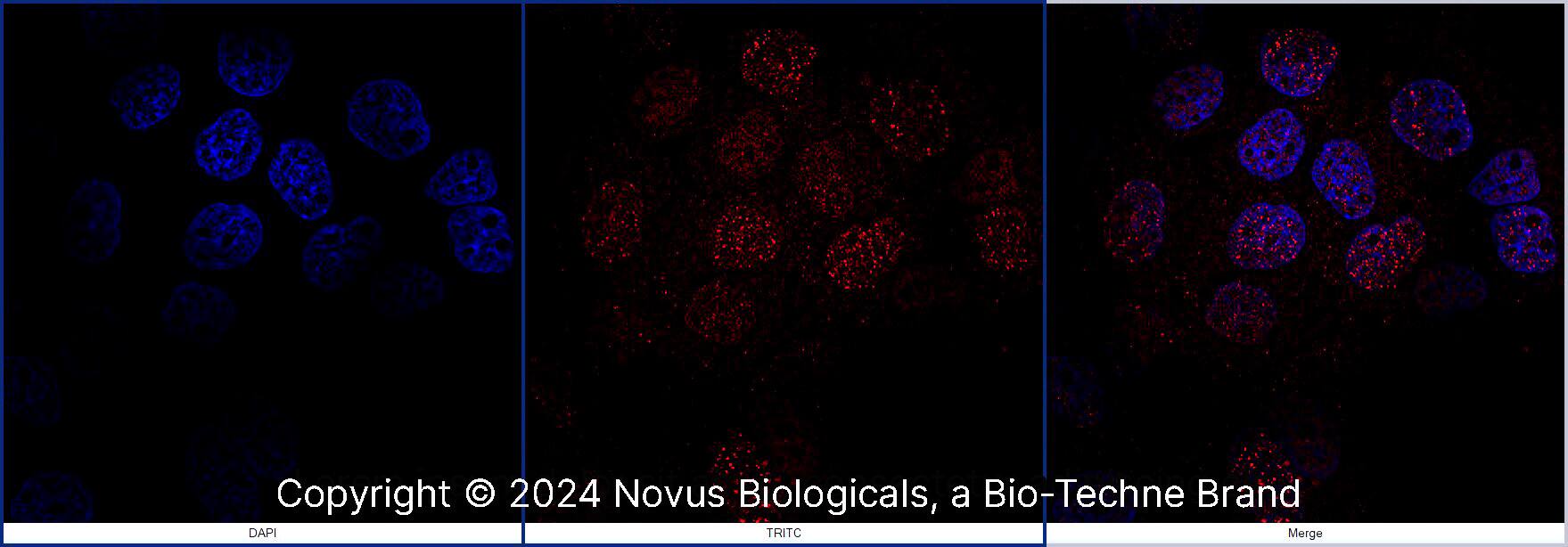 FANCD2 Antibody [DyLight 550]