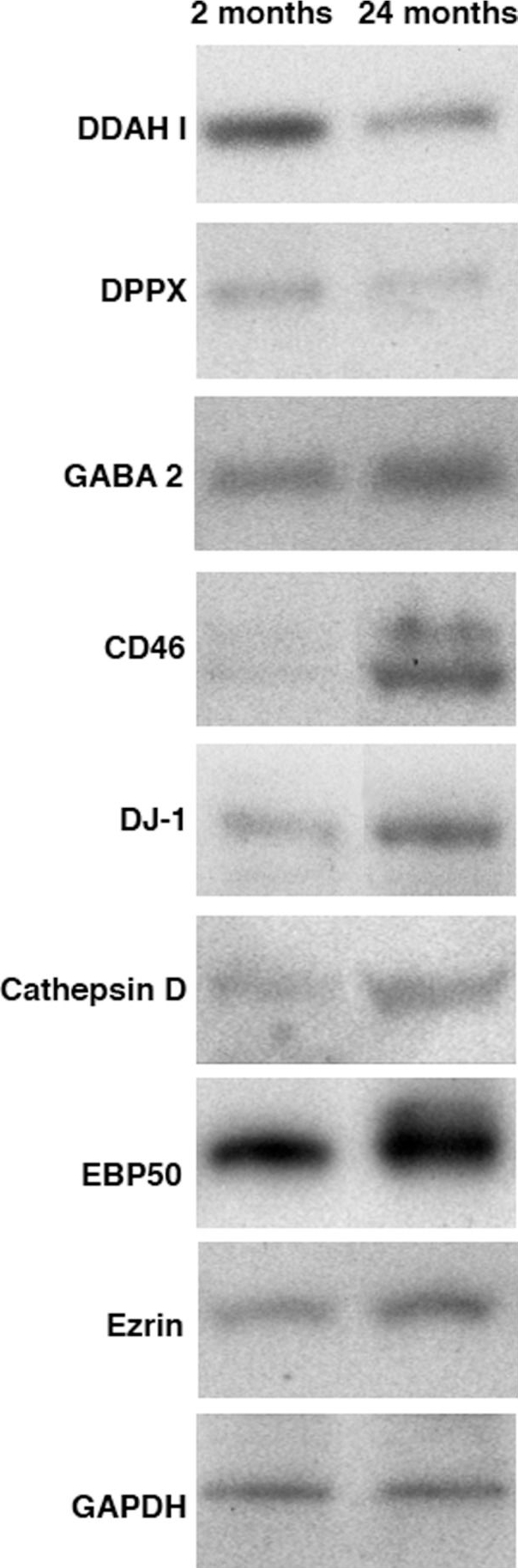GABA Transporter 2 Antibody