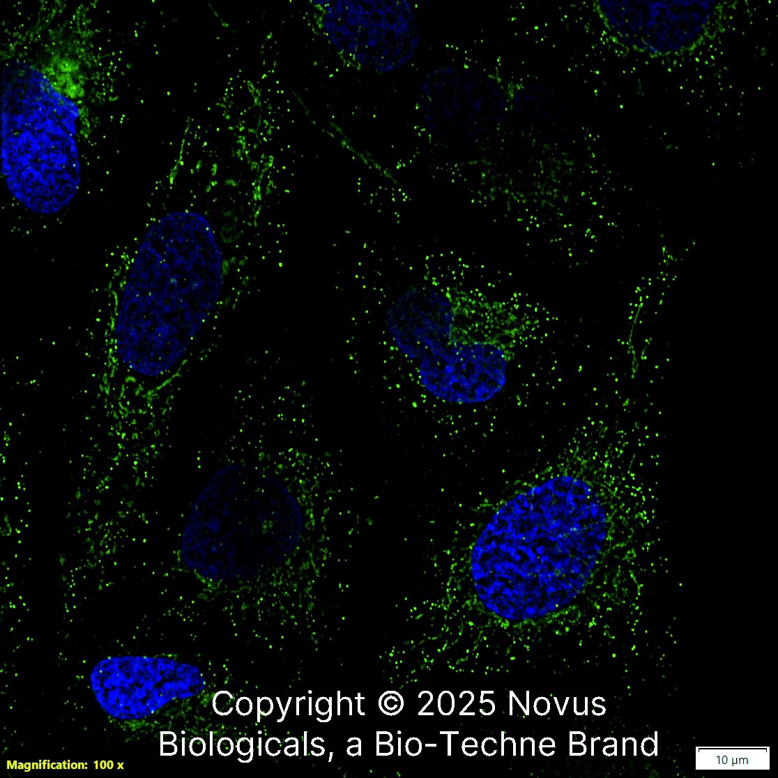 CD74 Antibody (PIN.1) [FITC]