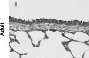 SOD2/Mn-SOD Antibody
