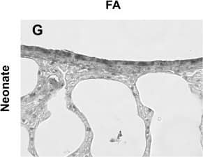 SOD2/Mn-SOD Antibody
