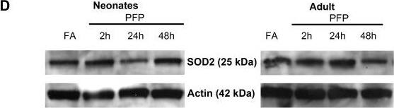 SOD2/Mn-SOD Antibody