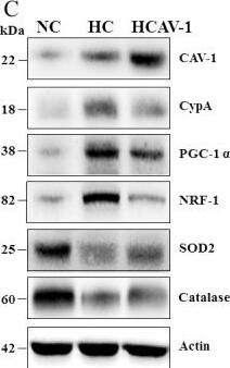 SOD2/Mn-SOD Antibody