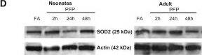 SOD2/Mn-SOD Antibody