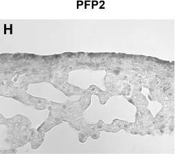 SOD2/Mn-SOD Antibody