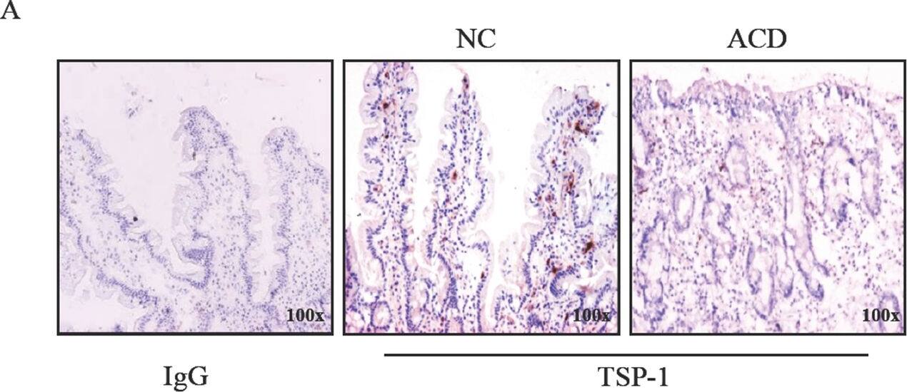 Thrombospondin-1 Antibody (A6.1)