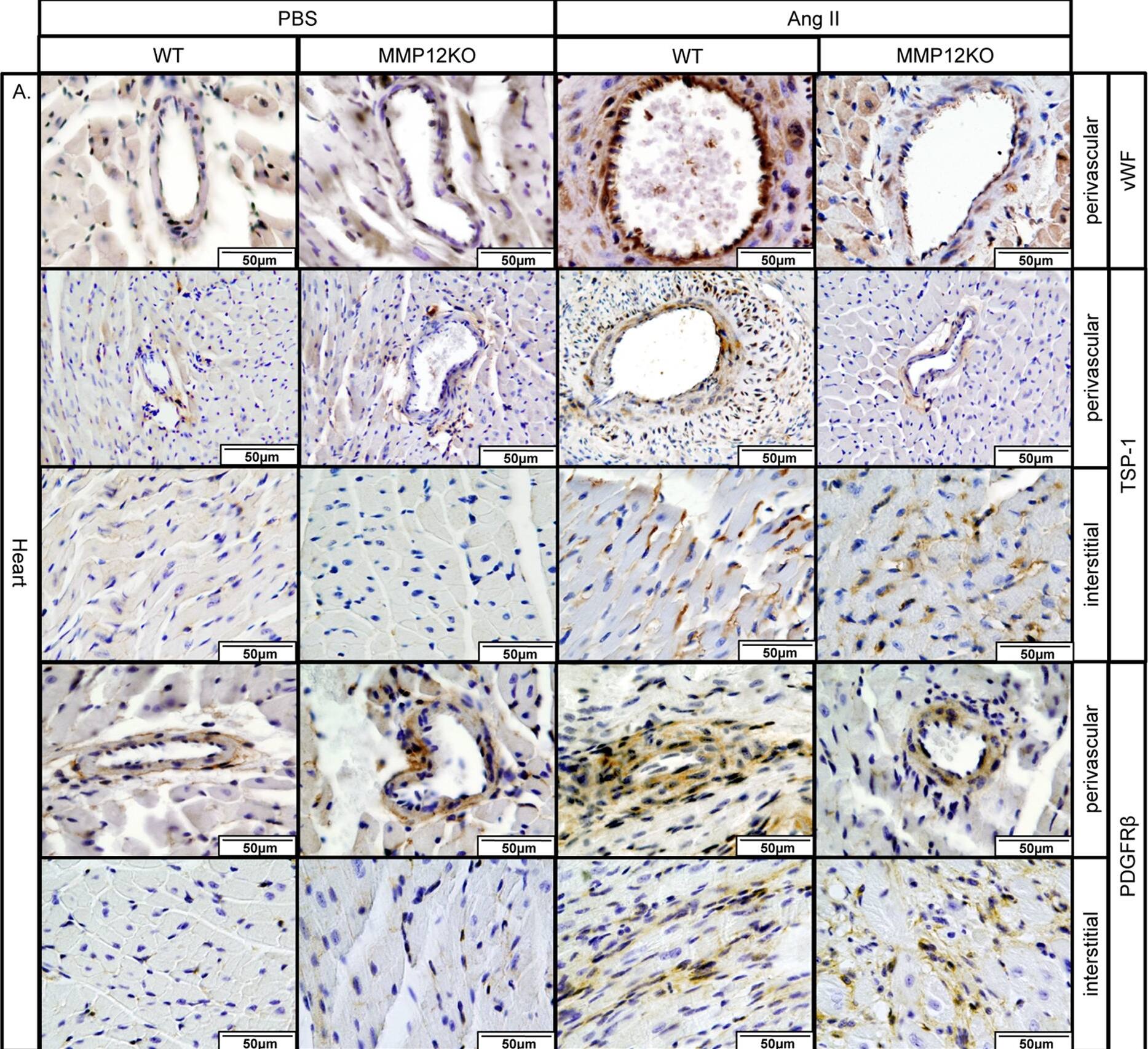 Thrombospondin-1 Antibody (A6.1)