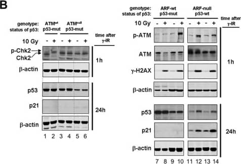ATM Antibody (5C2)
