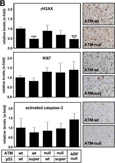 ATM Antibody (5C2)