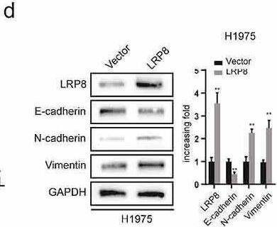 Apolipoprotein E R2/ApoE R2 Antibody - BSA Free